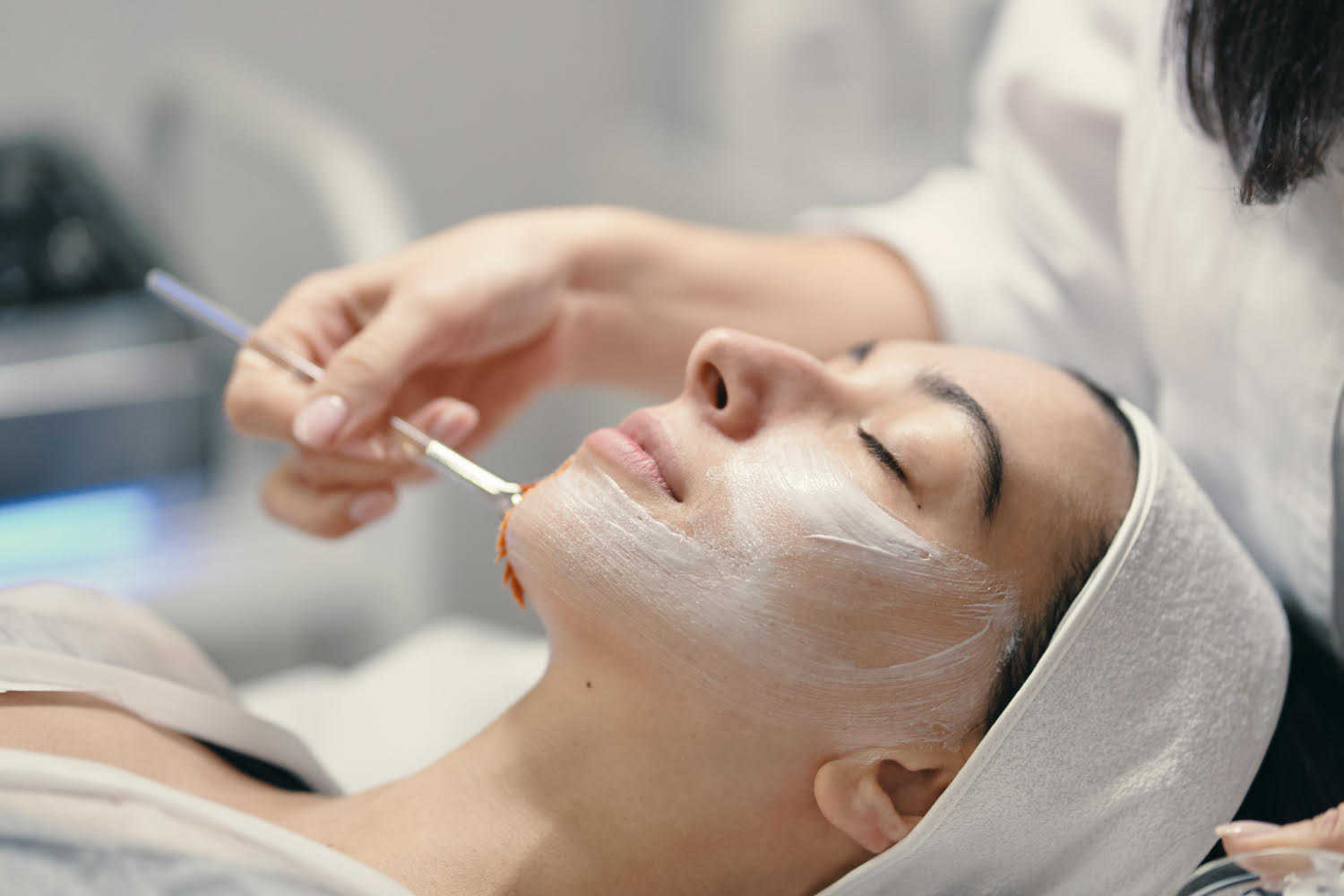 Effective chemical peel treatment in hyderabad